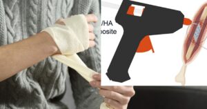 Drukarka kości wytwarza implanty precyzyjnie w miejscu ich zastosowania
