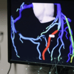 Medicalgorithmics zawarło umowę na dystrybucję z partnerem z Arabii Saudyjskiej
